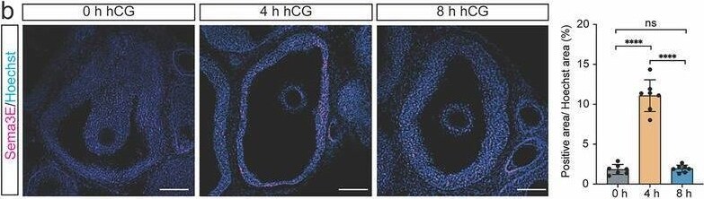 Detection of Semaphorin 3E by Immunohistochemistry