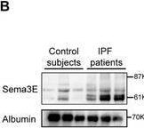 Detection of Semaphorin 3E by Western Blot
