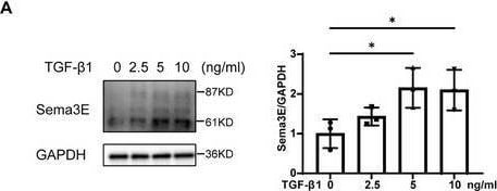 Detection of Semaphorin 3E by Western Blot