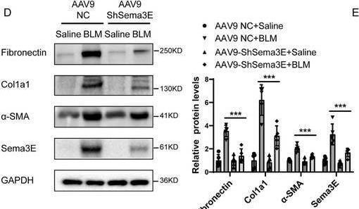 Detection of Semaphorin 3E by Western Blot