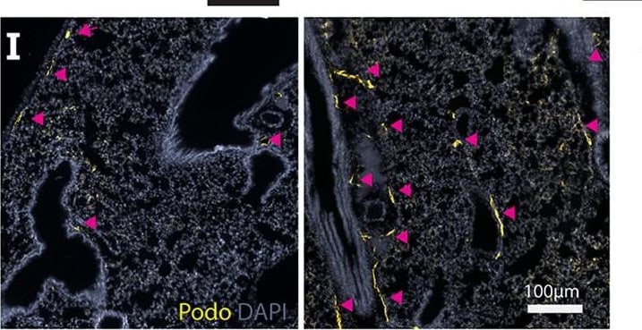 Detection of Mouse Mouse Podoplanin Antibody by Immunohistochemistry-Paraffin