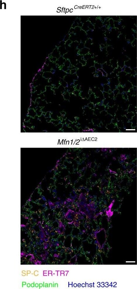 Detection of Mouse Podoplanin by Immunocytochemistry/Immunofluorescence