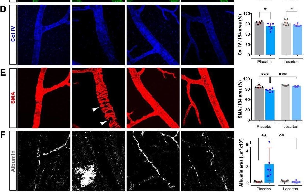 Detection of Serum Albumin by Immunohistochemistry