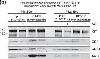 Detection of CD117/c-kit by Western Blot
