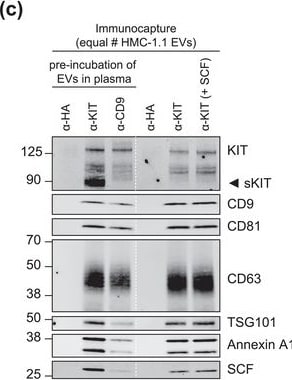 Detection of CD117/c-kit by Western Blot