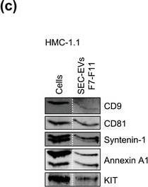 Detection of CD117/c-kit by Western Blot