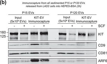 Detection of CD117/c-kit by Western Blot