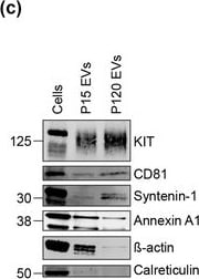 Detection of CD117/c-kit by Western Blot