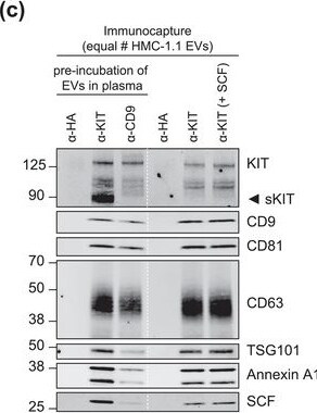 Detection of CD117/c-kit by Western Blot