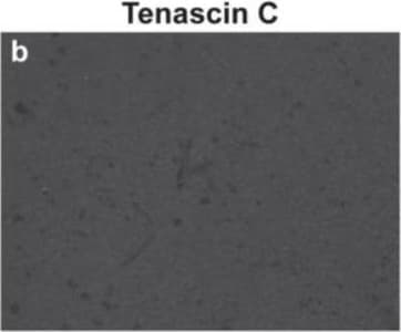 Detection of Human Tenascin C by Immunohistochemistry