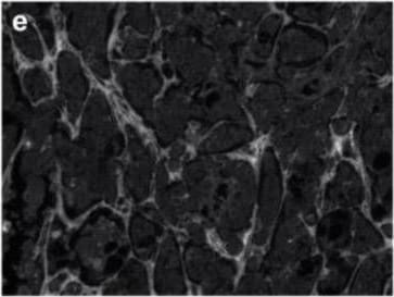 Detection of Human Tenascin C by Immunohistochemistry
