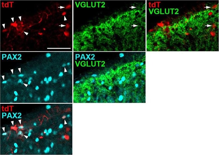 Detection of Rat Human Pax2 Antibody by Immunohistochemistry