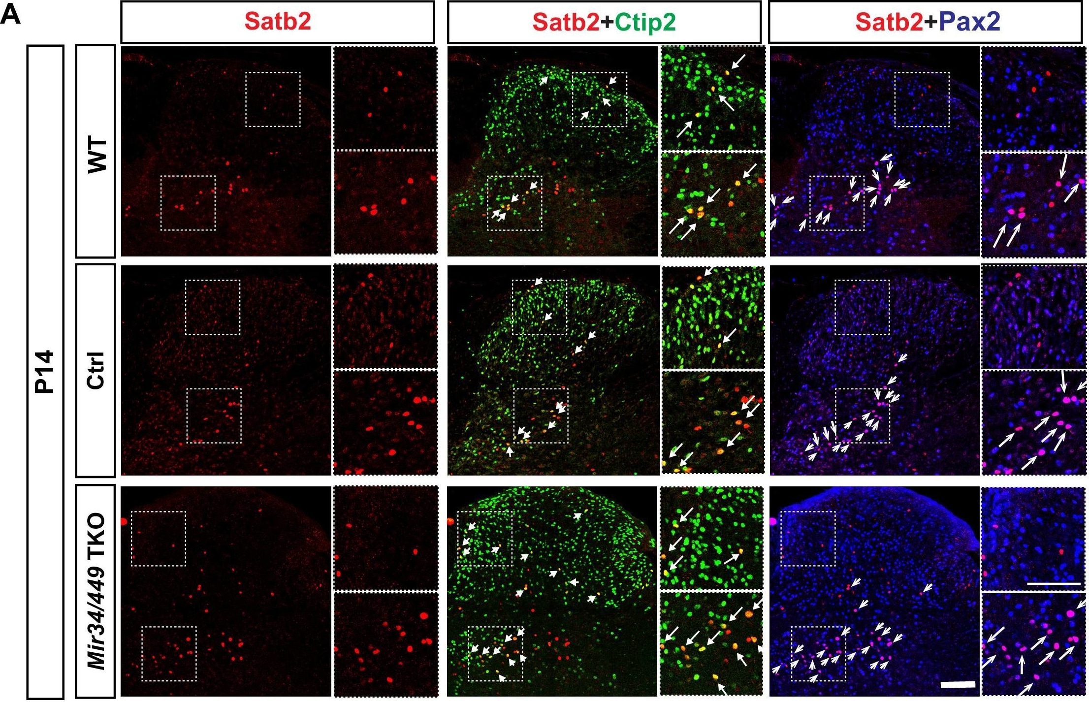 Detection of Mouse Pax2 by Immunohistochemistry