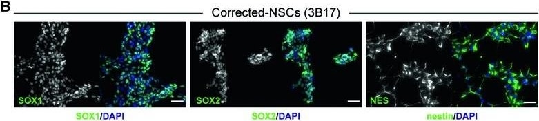 Detection of Human SOX1 by Immunocytochemistry/Immunofluorescence