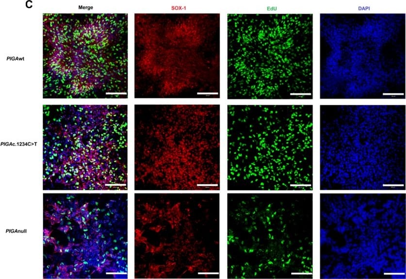 Detection of Human SOX1 by Immunocytochemistry/Immunofluorescence