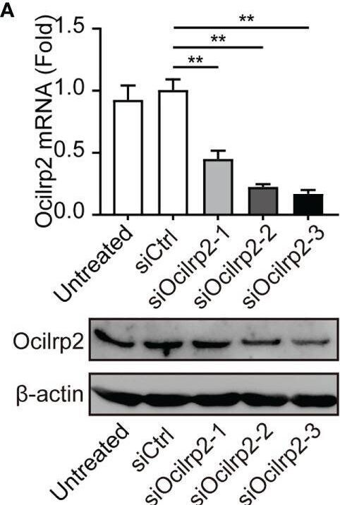 Detection of OCILRP2/CLEC2i by Western Blot
