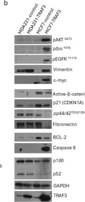 Detection of Phospho-EGFR (Y845) by Western Blot