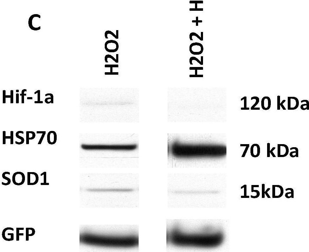 Detection of SOD1/Cu-Zn SOD by Western Blot