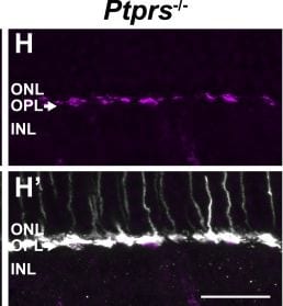 Detection of PTPR sigma by Immunohistochemistry