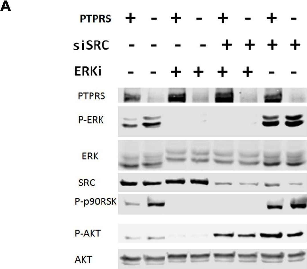 Detection of PTPR sigma by Western Blot