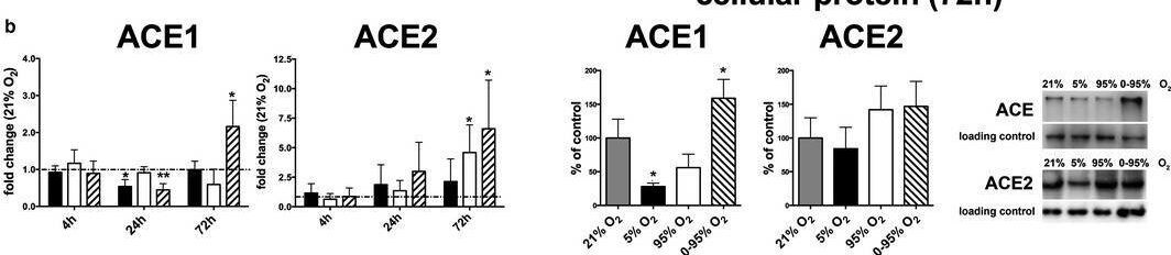 Detection of ACE-2 by Western Blot
