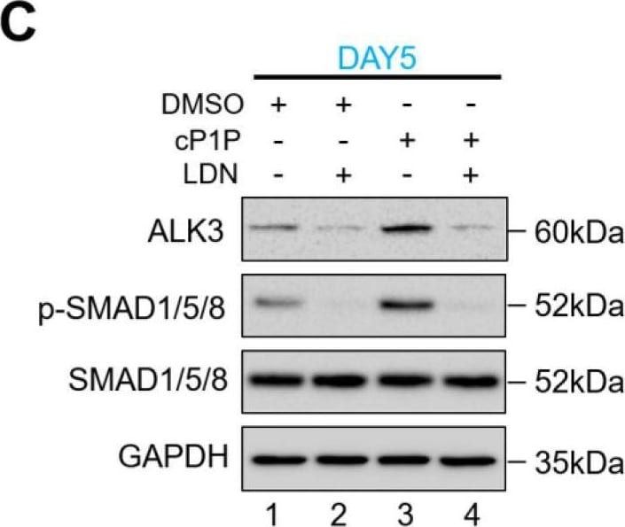 Detection of Human BMPR-IA/ALK-3 by Western Blot