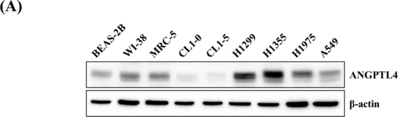 Detection of Angiopoietin-like Protein 4/ANGPTL4 by Western Blot