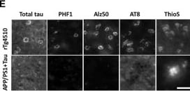 Detection of Tau by Immunocytochemistry/ Immunofluorescence