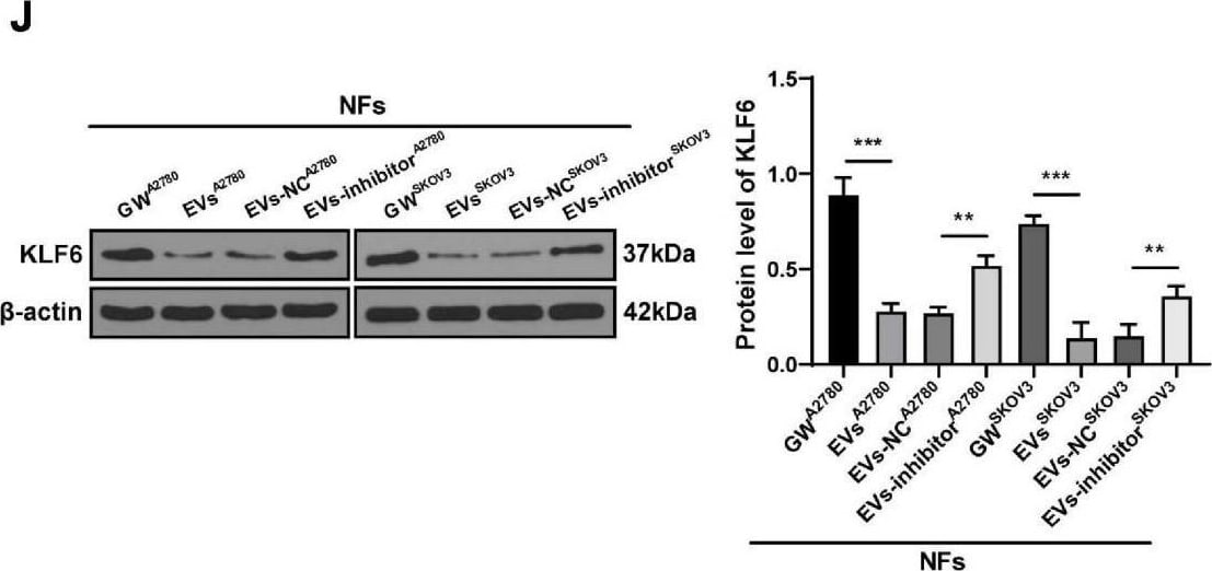 Detection of KLF6 by Western Blot