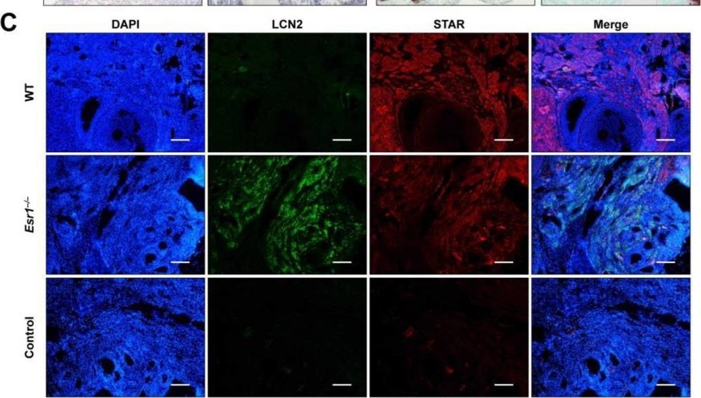 Detection of Mouse Lipocalin-2/NGAL by Immunohistochemistry