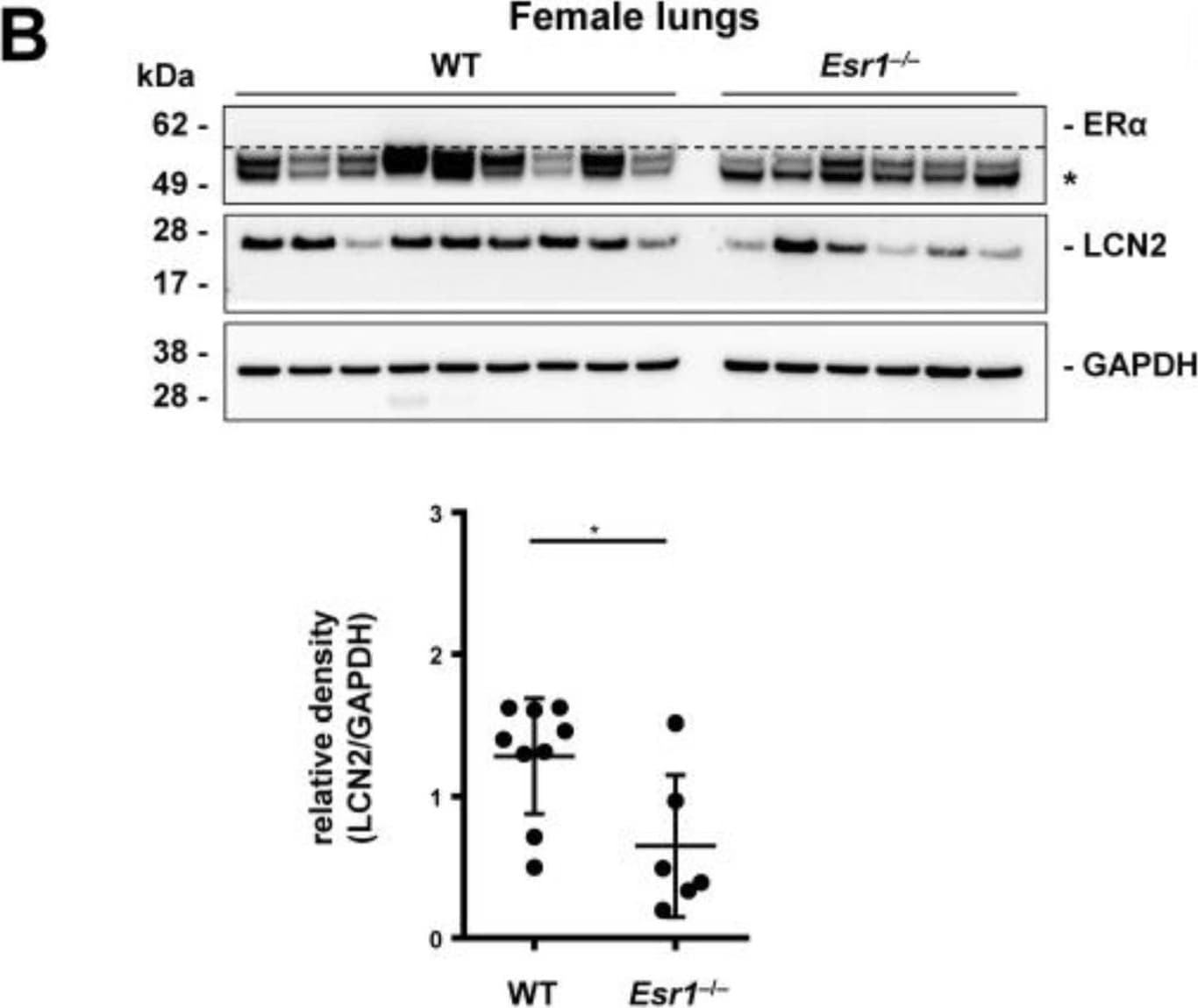 Detection of Mouse Lipocalin-2/NGAL by Western Blot
