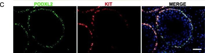 Detection of Endoglycan/PODXL2 by Immunohistochemistry