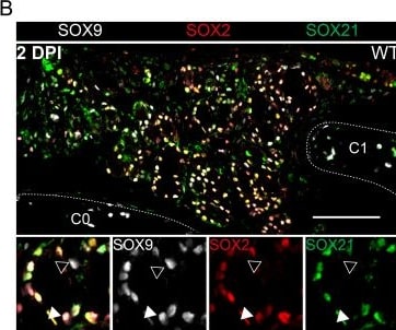 Detection of SOX21 by Immunohistochemistry