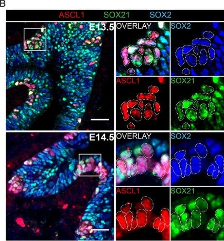 Detection of SOX21 by Immunohistochemistry