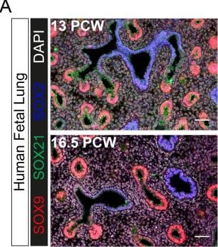 Detection of SOX21 by Immunohistochemistry