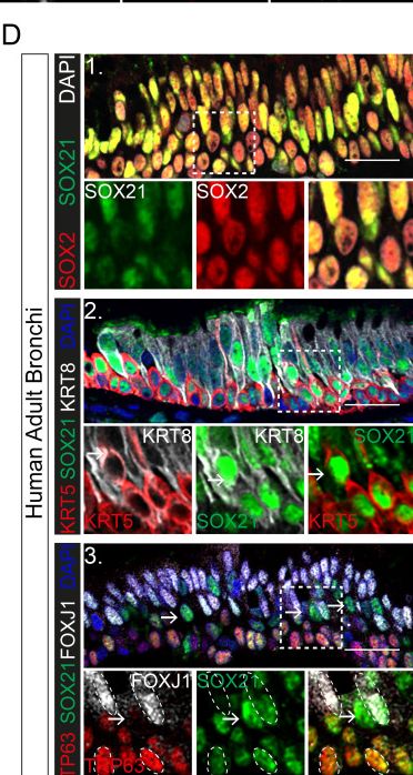 Detection of SOX21 by Immunohistochemistry