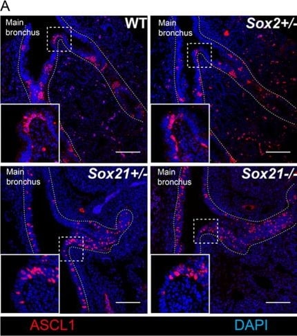 Detection of SOX21 by Immunohistochemistry