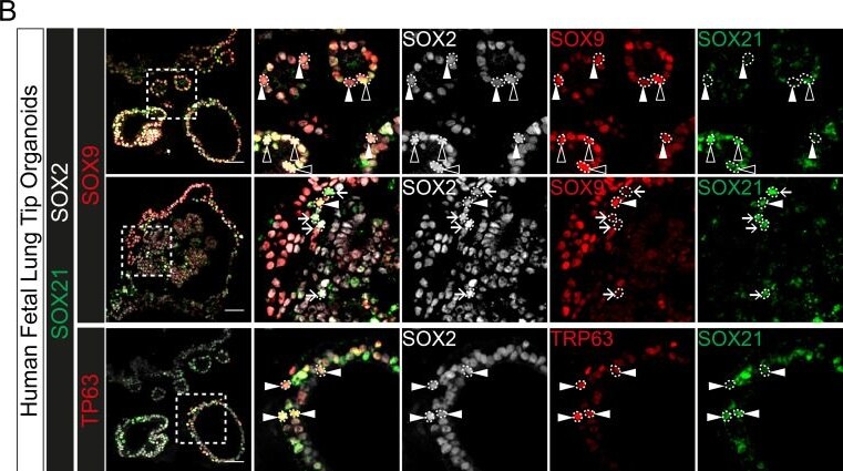 Detection of SOX21 by Immunohistochemistry
