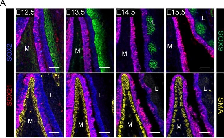 Detection of SOX21 by Immunohistochemistry