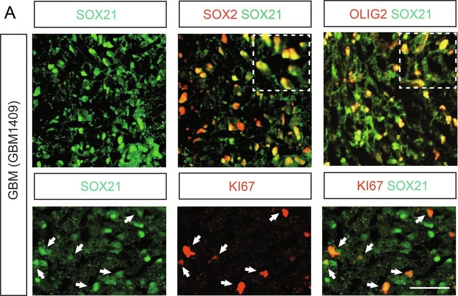 Detection of SOX21 by Immunohistochemistry