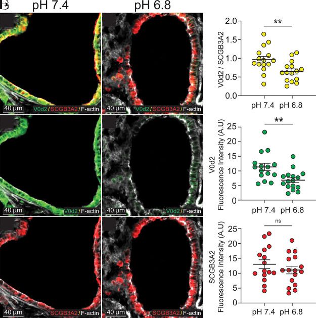 Detection of UGRP1 by Immunohistochemistry