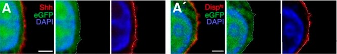 Detection of DISP1 by Immunohistochemistry