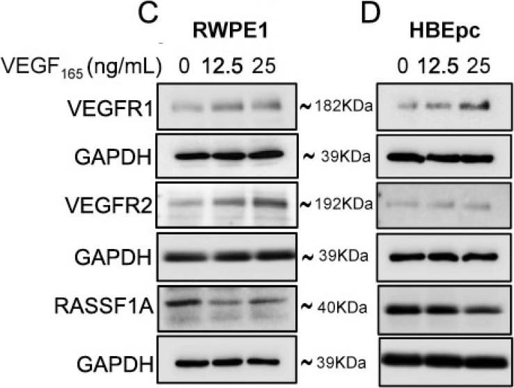 Detection of Human VEGFR2/KDR/Flk-1 by Western Blot