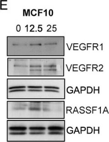 Detection of Human VEGFR2/KDR/Flk-1 by Western Blot