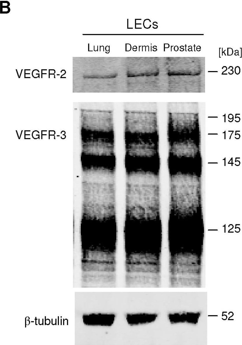 Detection of Human VEGFR2/KDR/Flk-1 by Western Blot