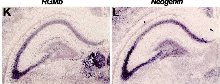 Detection of RGM-B by Immunohistochemistry