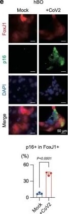Detection of FoxJ1 by Immunocytochemistry/ Immunofluorescence