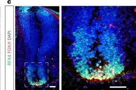 Detection of FoxJ1 by Immunohistochemistry