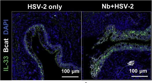 Detection of Mouse Mouse IL-33 Antibody by Immunohistochemistry
