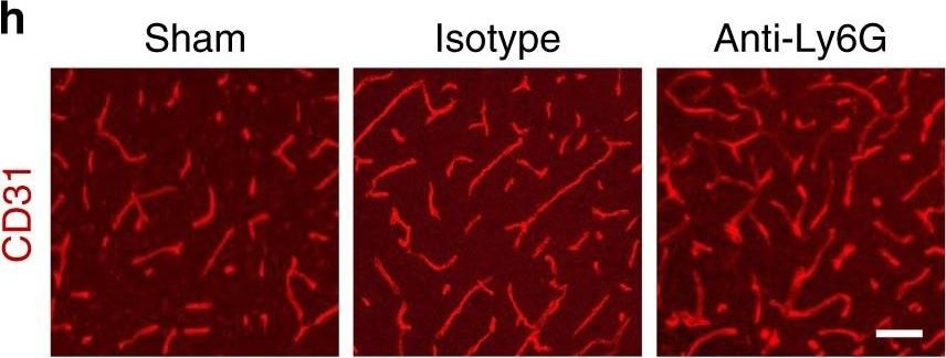 Detection of Mouse Human/Mouse/Rat CD31/PECAM-1 Antibody by Immunohistochemistry